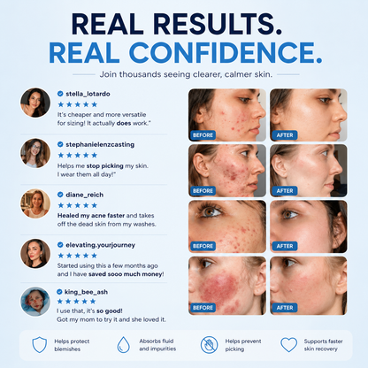 Skincosmetics Hydrocolloid Roll™